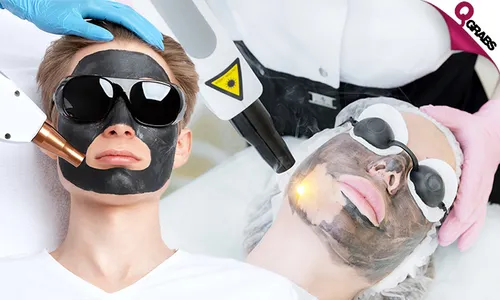 Carbon Laser Resurfacing Facial!